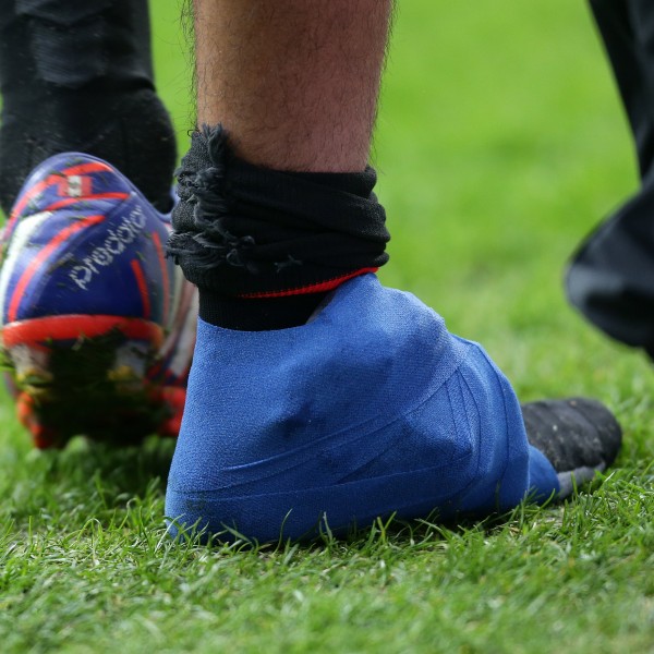 Hat die Eintracht im Gegensatz zu den anderen Vereinen häufiger Verletzungen zu beklagen?