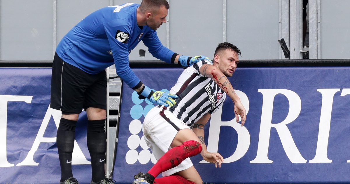 SGE-Neuzugang Danny Blum spielte das Testspiel gegen Wehen-Wiesbaden trotz einer Platzwunde am Arm zu Ende.
