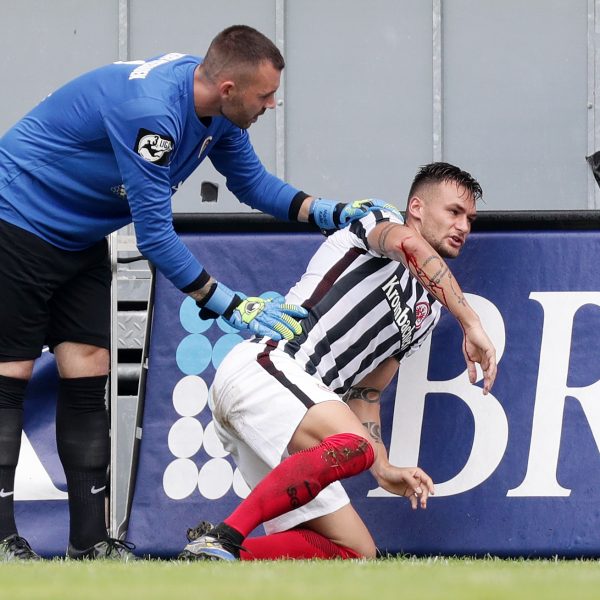 SGE-Neuzugang Danny Blum spielte das Testspiel gegen Wehen-Wiesbaden trotz einer Platzwunde am Arm zu Ende.
