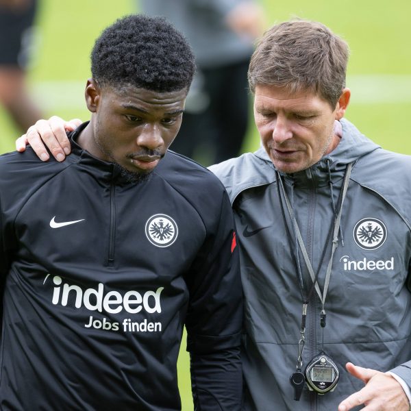  Ebimbes Reha verläuft bislang zur Zufriedenheit von Trainer Glasner (Foto: imago / Kessler-Sportfotografie)